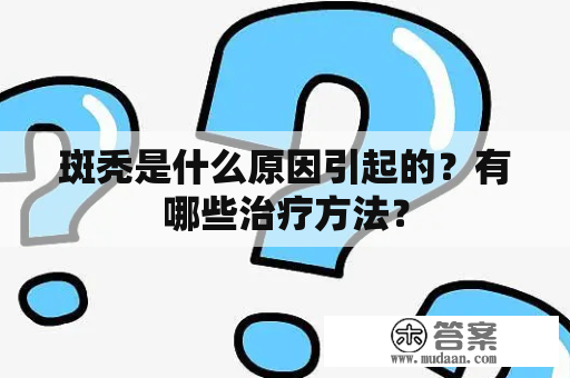 斑秃是什么原因引起的？有哪些治疗方法？