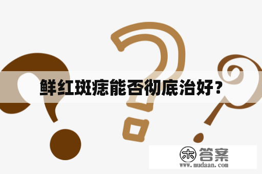 鲜红斑痣能否彻底治好？