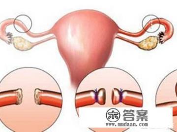 除了避孕套这类的，现代女性最好的避孕方式有哪些