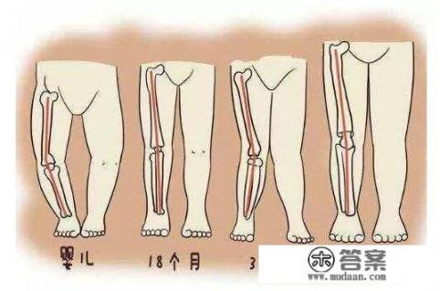 宝宝长期用纸尿裤会形成八字腿吗