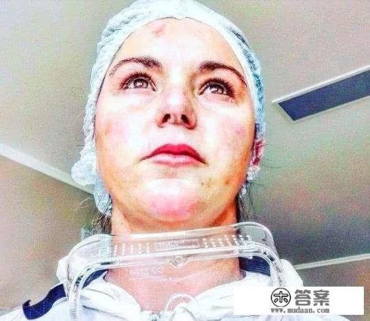 俄罗斯女护士穿透明防护服护理病人被曝光，对此你是怎么看的