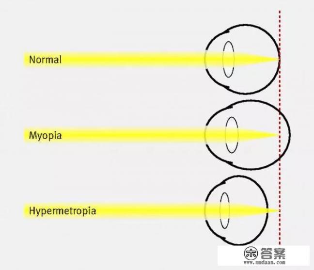 关心儿童健康成长，儿童视力发展您忽视了吗