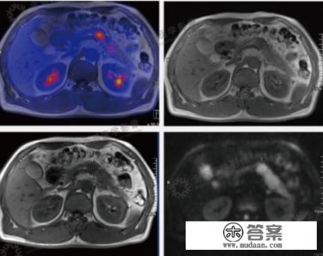 你所了解的健康体检是什么