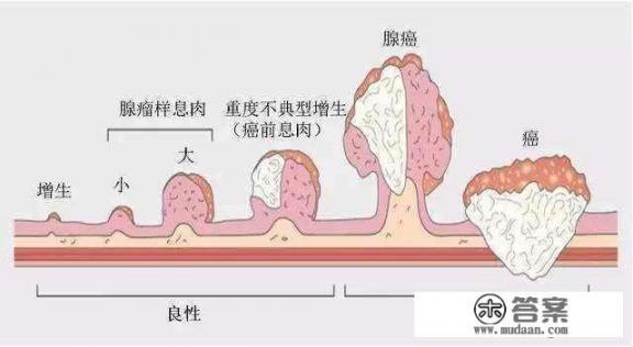 胃息肉有什么危害