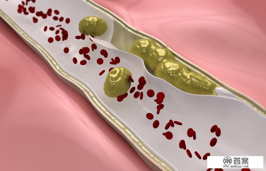 血管堵塞，身体会有哪几处“疼痛”_血管堵塞怎么快速清理