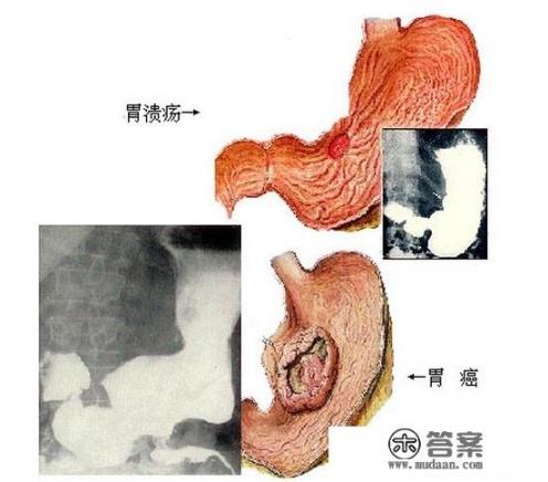 人在大限将至的时候会有什么反常举动_大便有好多形状，都代表着哪些疾病