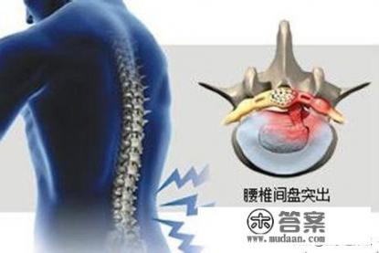 中医药外敷可以完全治好生不如死的腰椎突出吗