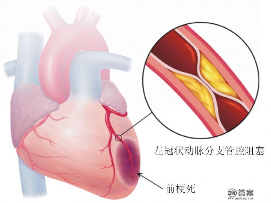 吃了黑豆就不会发生心肌梗死吗？吃黑豆有什么作用