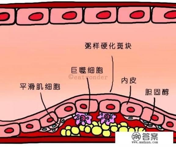 高脂肪高胆固醇的食物有哪些？