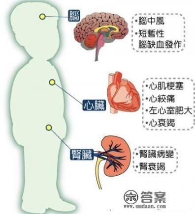 治疗高血压最好的药大概多少钱，是不是越贵越好？