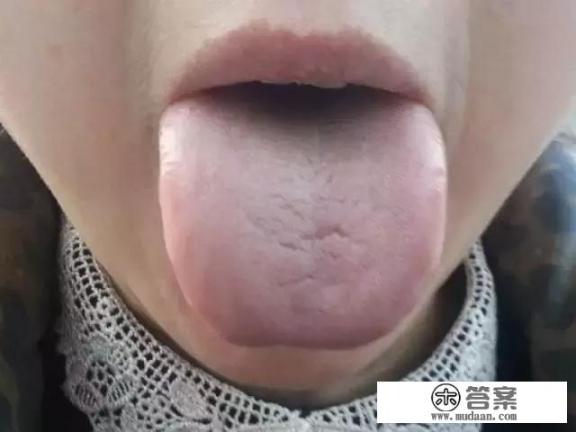 肾虚怎么补？吃什么见效快？