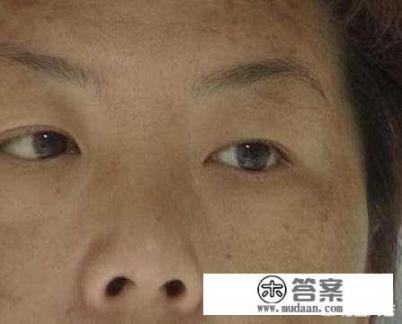 蜂蜜淡斑最简单有效的方法？