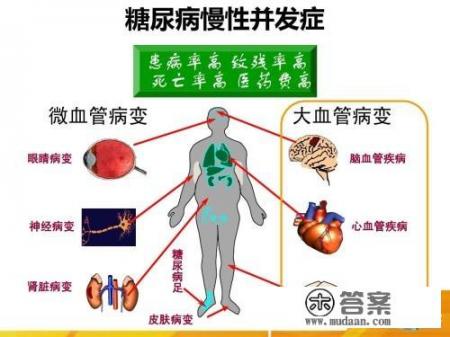 糖尿病人能吃银耳吗？