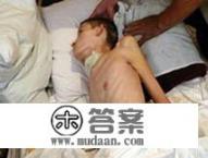 怎么才能快速瘦下来? 怎么才能快速瘦下来?