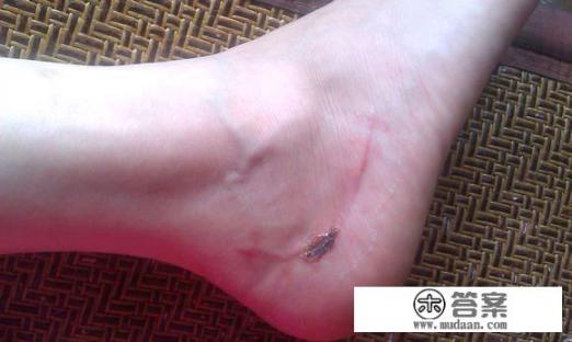 人参果冻了解冻后能不能吃? 人参果冻了解冻后能不能吃?