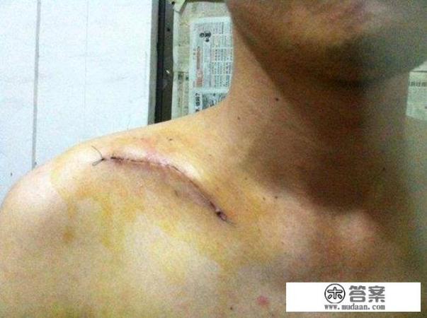 人参果冻了解冻后能不能吃? 人参果冻了解冻后能不能吃?