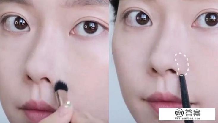 蒜头鼻怎么修？