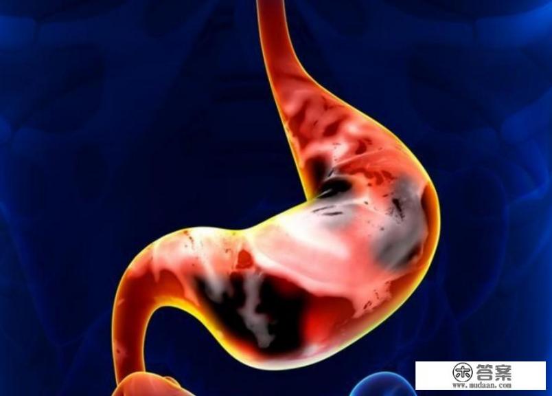 胃疼怎么缓解? 胃疼怎么缓解?