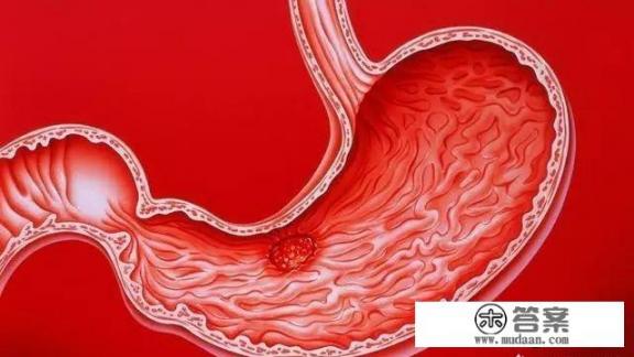 胃疼怎么缓解? 胃疼怎么缓解?