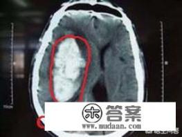 mri是什么部分？