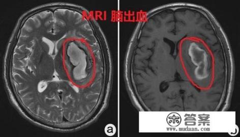 mri是什么部分？