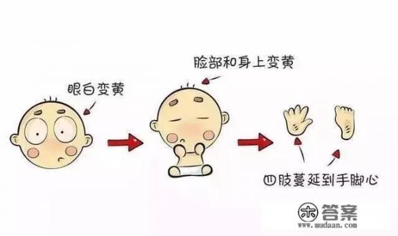 黄疸正常值是多少？