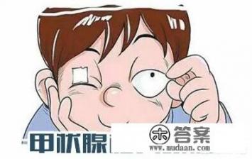 甲亢会有哪些症状表现出来？