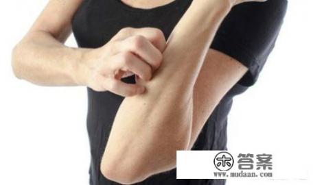 荨麻疹是什么？