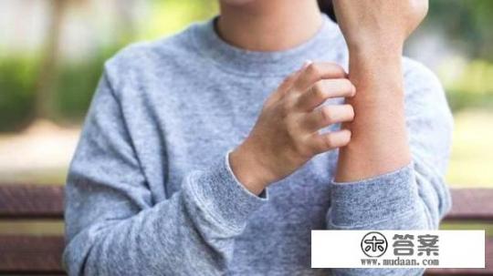 荨麻疹是什么？