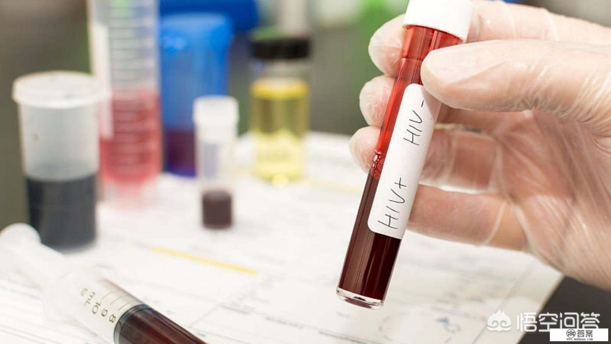 由艾滋病人转为携带者的标志是什么？