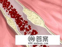 血脂高少吃什么食物? 血脂高少吃什么食物?