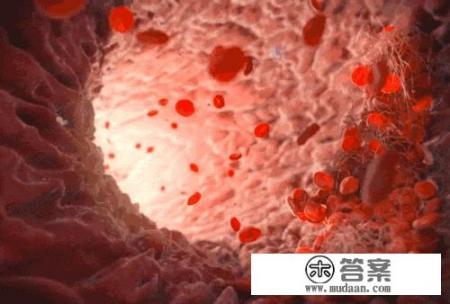 血脂高少吃什么食物? 血脂高少吃什么食物?