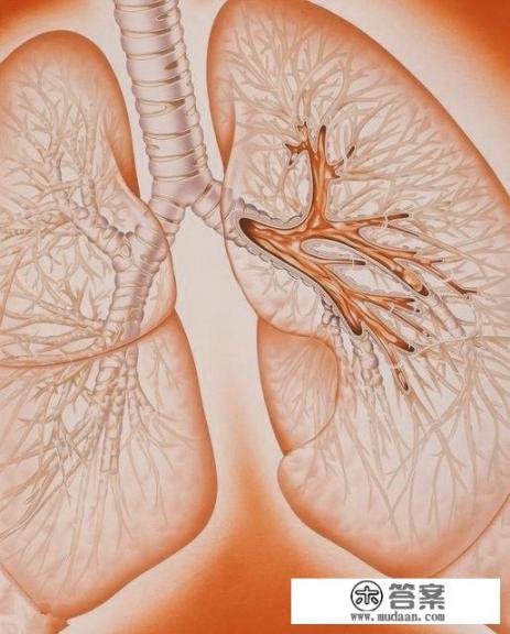 咳出的痰里带有果冻状物体是什么? 咳出的痰里带有果冻状物体是什么?