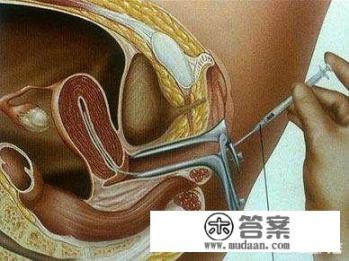 为什么明星生双胞胎的概率那么高? 为什么明星生双胞胎的概率那么高?