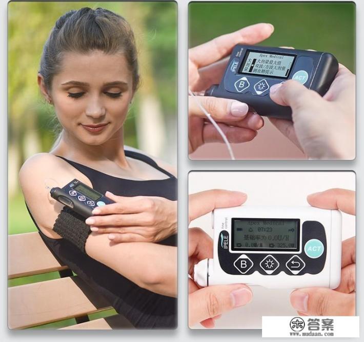 胰岛素泵多少钱国产的多少钱进口的多少钱?