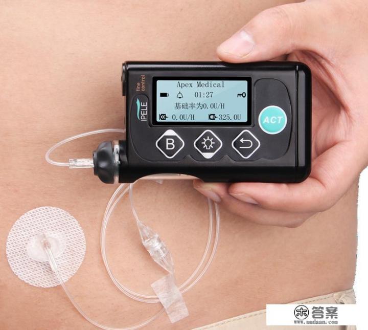 胰岛素泵多少钱国产的多少钱进口的多少钱? 胰岛素泵多少钱国产的多少钱进口的多少钱?