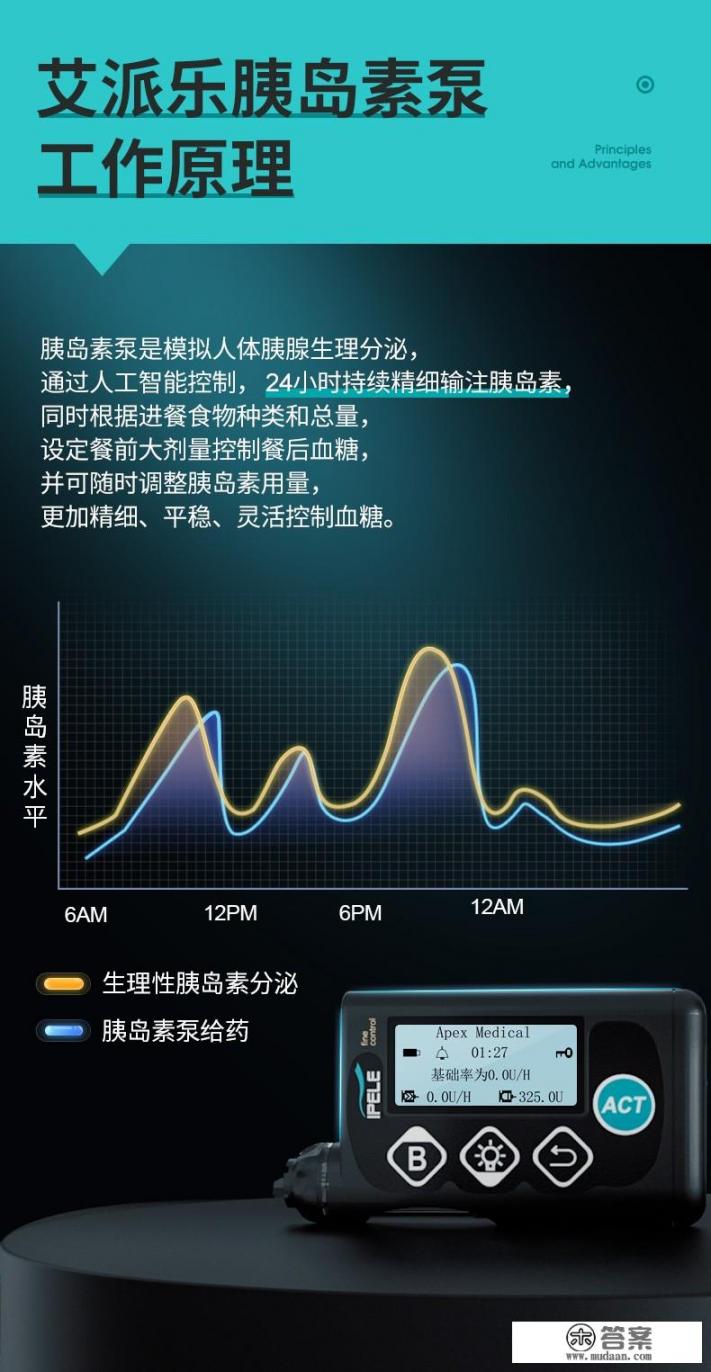 胰岛素泵多少钱国产的多少钱进口的多少钱? 胰岛素泵多少钱国产的多少钱进口的多少钱?