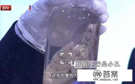 如何尽早避免肝癌? 如何尽早避免肝癌?