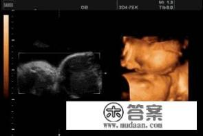 孕80天的时候,双胞胎胎儿在肚子里的样子是怎么样的? 孕80天的时候,双胞胎胎儿在肚子里的样子是怎么样的?