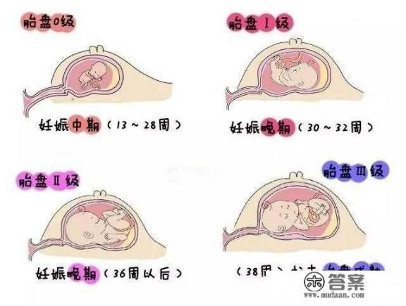 孕80天的时候,双胞胎胎儿在肚子里的样子是怎么样的? 孕80天的时候,双胞胎胎儿在肚子里的样子是怎么样的?