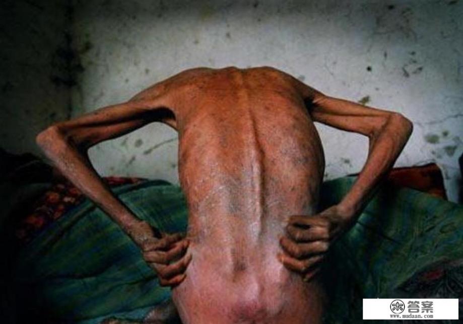 贵阳市两岁的婴儿感染艾滋病毒,父母都健康,你对此有什么看法? 贵阳市两岁的婴儿感染艾滋病毒,父母都健康,你对此有什么看法?