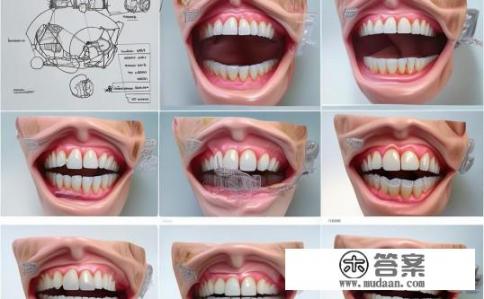 龅牙矫正的步骤是什么？如何科学有效地进行龅牙矫正?