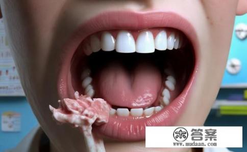 舌苔厚白发烧怎么回事?舌苔厚白发烧可能是感染或疾病的表现,包括但不限于,,呼吸道感染,如感冒、流感等引发的发热、咳嗽和咽喉疼痛。,病毒性感染,如肝炎、肺炎、扁桃体炎等引起的口腔黏膜炎症,以及手足口病、水痘等病毒感染引起的舌苔异常增厚。,食物过敏或消化系统问题,如食物中毒、口腔溃疡等引发的舌苔颜色异常。,药物副作用,某些药物可能引起口腔粘膜干燥、舌苔变厚等反应。,其他疾病,如甲状腺功能亢进、糖尿病等疾病也可能导致舌苔异常,表现为白色、粗糙或边缘不规则。,以上仅为常见可能性,具体原因还需结合患者的个人史、临床症状和其他相关检查结果进行综合判断。如果舌苔厚白伴随有其他症状,如呼吸困难、乏力、食欲减退等,应及时就医并接受专业医生的诊断和治疗。 舌苔厚白发烧怎么回事?舌苔厚白发烧可能是感染或疾病的表现,包括但不限于,,呼吸道感染,如感冒、流感等引发的发热、咳嗽和咽喉疼痛。,病毒性感染,如肝炎、肺炎、扁桃体炎等引起的口腔黏膜炎症,以及手足口病、水痘等病毒感染引起的舌苔异常增厚。,食物过敏或消化系统问题,如食物中毒、口腔溃疡等引发的舌苔颜色异常。,药物副作用,某些药物可能引起口腔粘膜干燥、舌苔变厚等反应。,其他疾病,如甲状腺功能亢进、糖尿病等疾病也可能导致舌苔异常,表现为白色、粗糙或边缘不规则。,以上仅为常见可能性,具体原因还需结合患者的个人史、临床症状和其他相关检查结果进行综合判断。如果舌苔厚白伴随有其他症状,如呼吸困难、乏力、食欲减退等,应及时就医并接受专业医生的诊断和治疗。