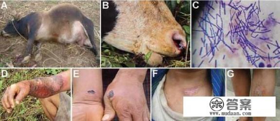 北京地铁能带药吗？