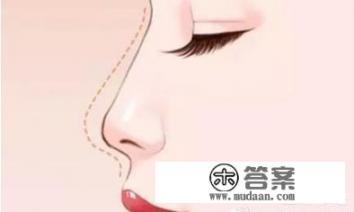 埋线手术隆鼻术后注意事项是什么？