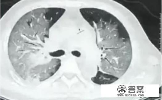 三公协同机制是什么意思? 三公协同机制是什么意思?
