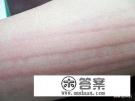 划痕和剐蹭怎么分? 划痕和剐蹭怎么分?