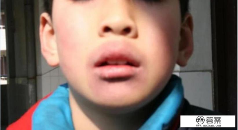 农村常说的顽疾“羊胡子”是什么? 农村常说的顽疾“羊胡子”是什么?