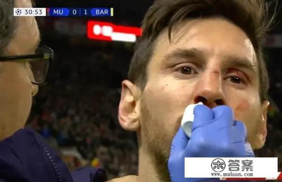 昨晚巴萨1:0曼联，梅西受伤，回到诺坎普球场你希望梅西上场吗？