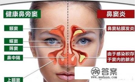 鼻窦炎的症状表现有哪些？